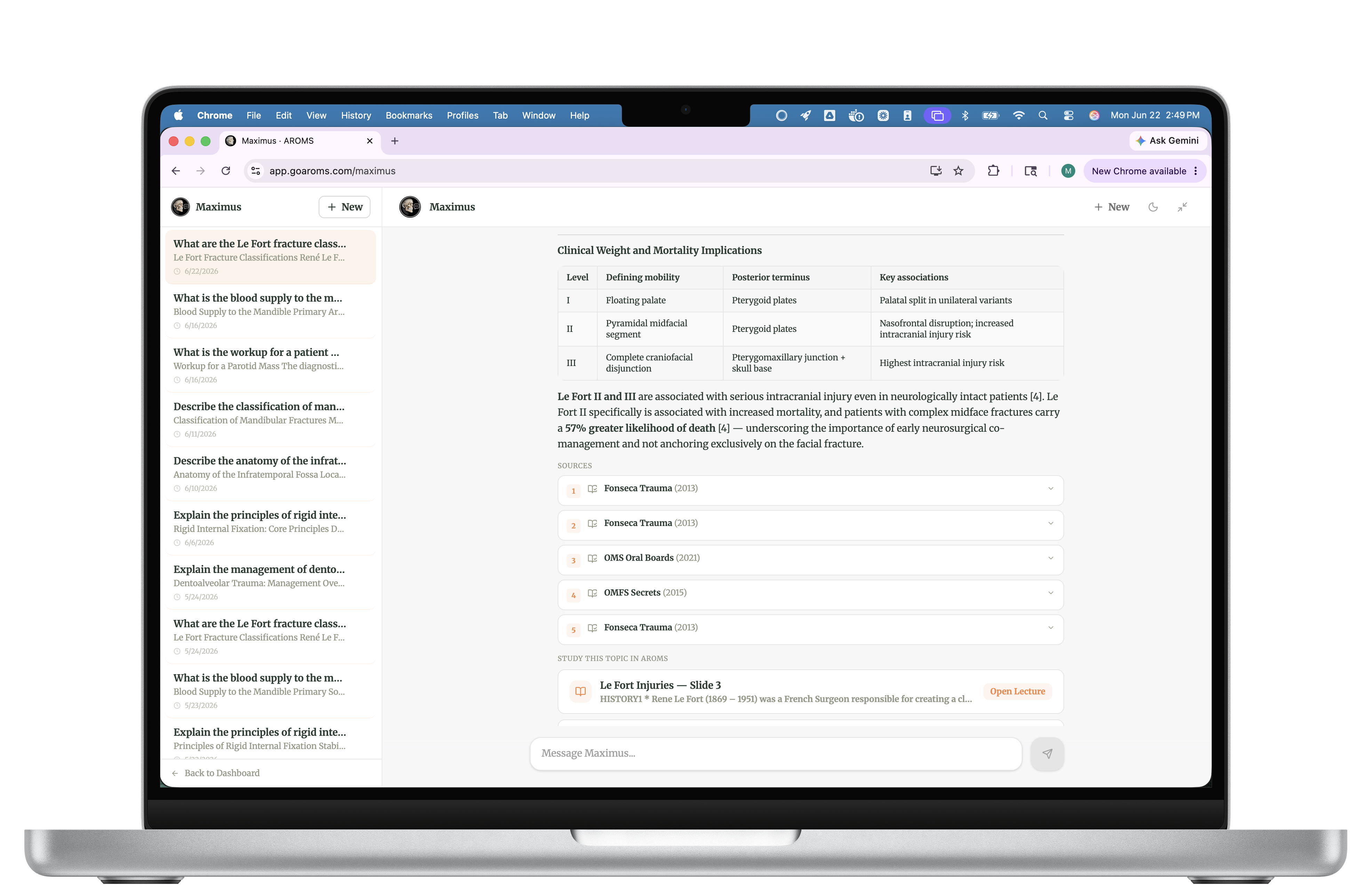 Maximus AI on a MacBook
